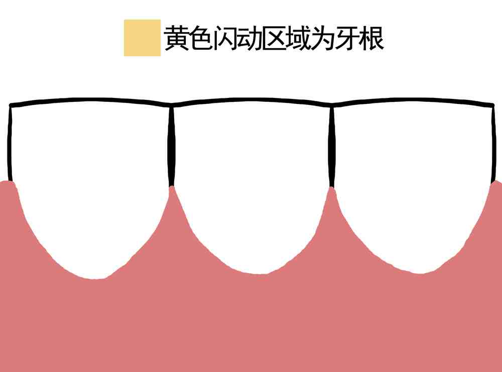 牙齿松动了能恢复吗（松动了的牙齿可以恢复牢固吗）-第3张图片