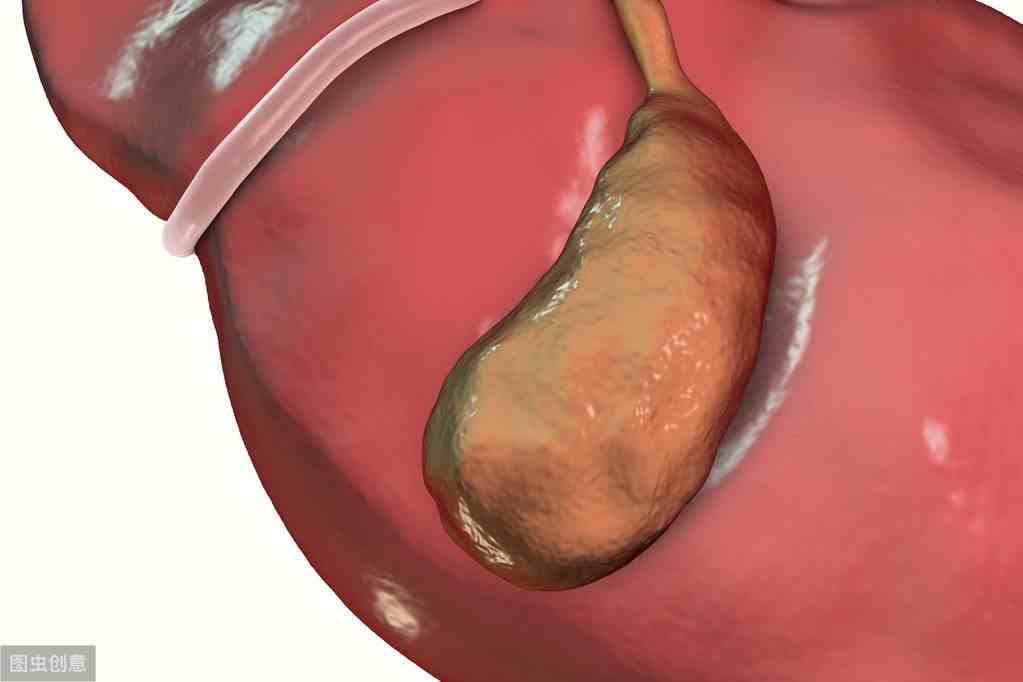 胆囊息肉严重吗（胆囊息肉是怎么回事）-第2张图片