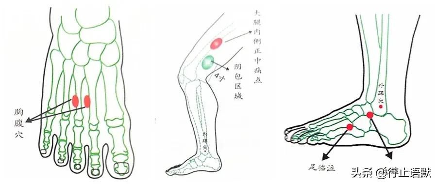 带状疱疹后遗症(带状疱疹后遗症的偏方 )-第5张图片