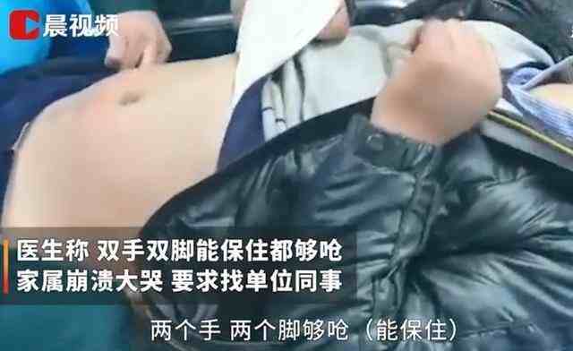 男子醉酒睡街头被冻僵或手脚难保（手冻僵怎么缓解？）-第3张图片